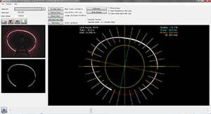 WinCan Laser Scan